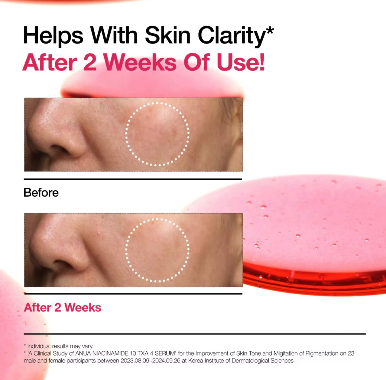 Anua NIACINAMIDE 10 + TXA 4 SERUM