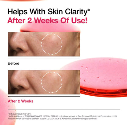 Anua NIACINAMIDE 10 + TXA 4 SERUM